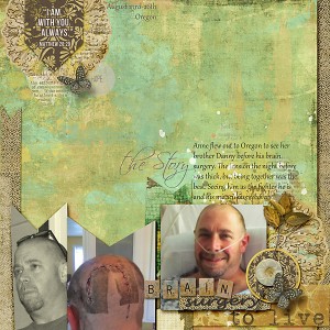 brain surgery to live