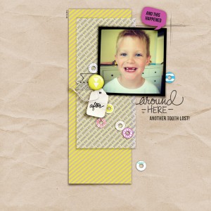 another tooth lost