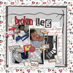 Broken Leg