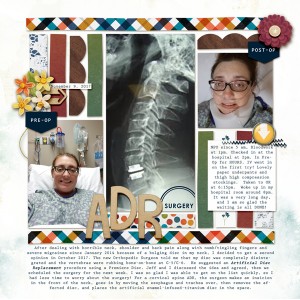 ADR surgery