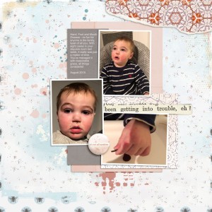Hand, Foot and Mouth Disease