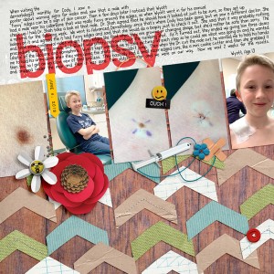 Mole Removal and Biopsy