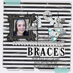 Braces