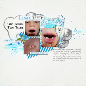 Gabe-first-2-teeth