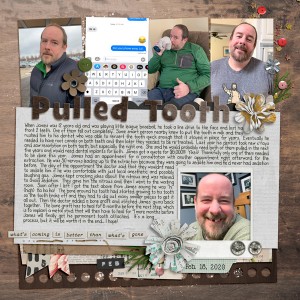 Pulled Tooth
