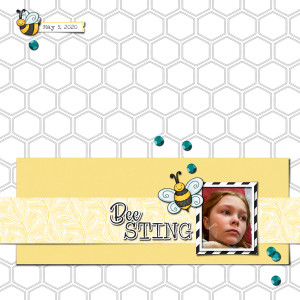 Bee Sting