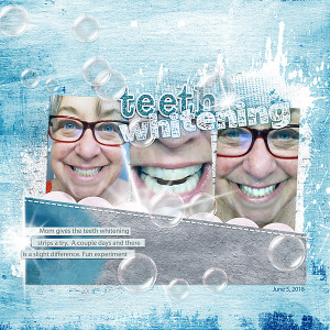 06052018-white-teeth-copy
