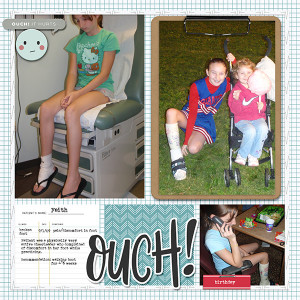 Broken Foot