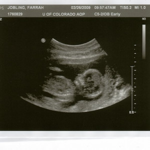 Baby2FEB26