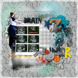 brain tumor