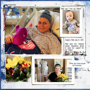 Becky's Surgery & Discharge Days_left