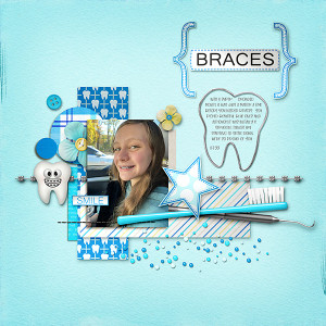 Braces!