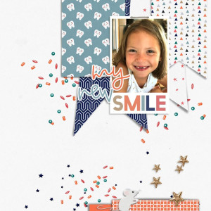 My new smile !