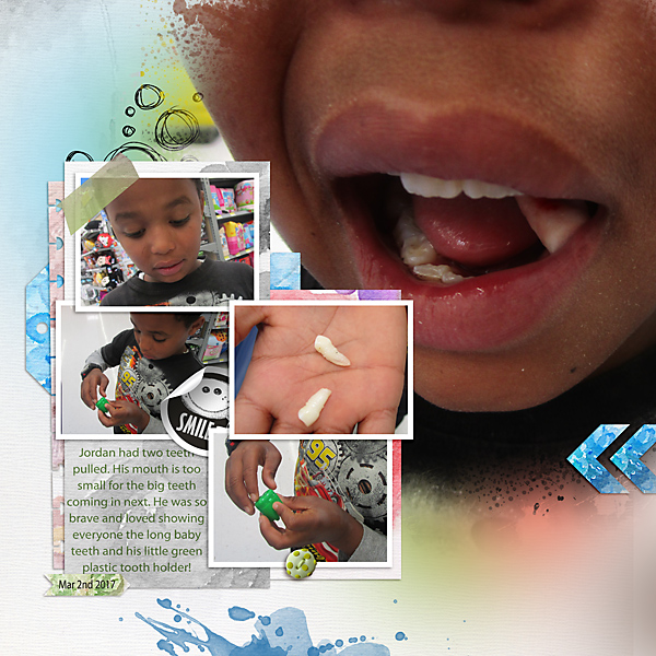 03022017-j-teeth-pull-copy