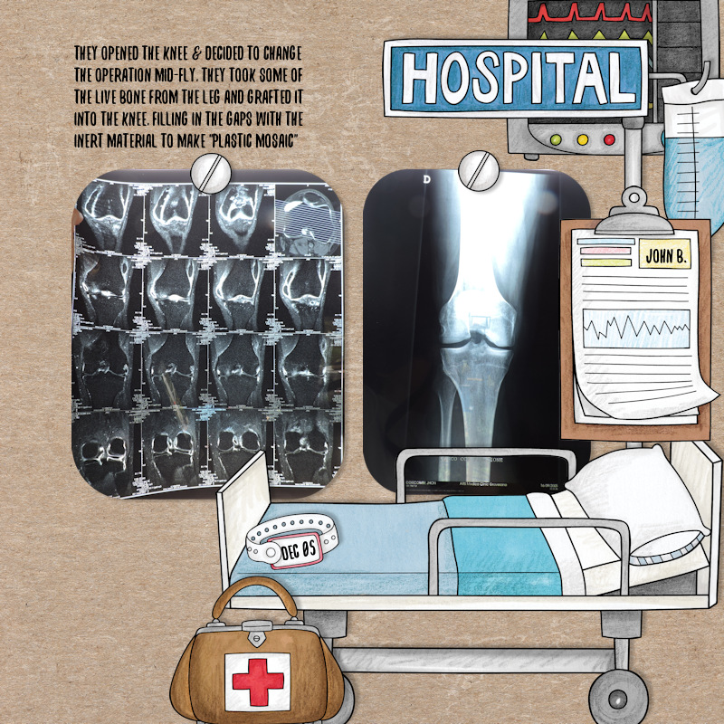 05dec_knee01