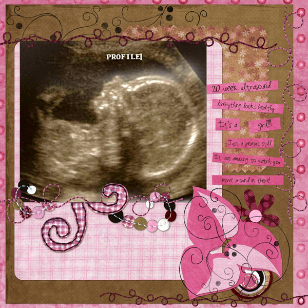 20 Wk Ultrasound