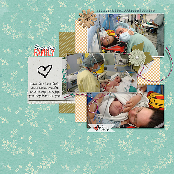 Azure-lee C-Section