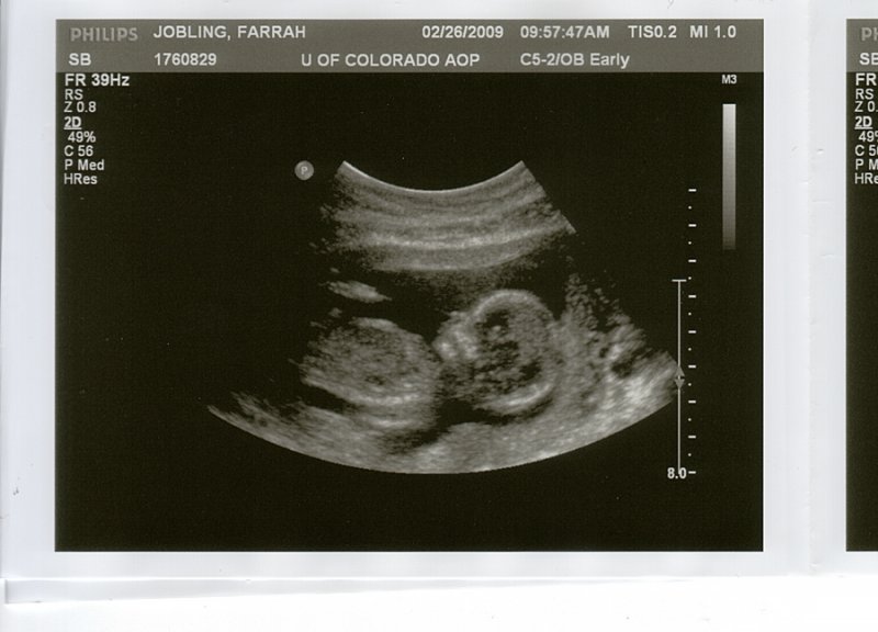 Baby2FEB26