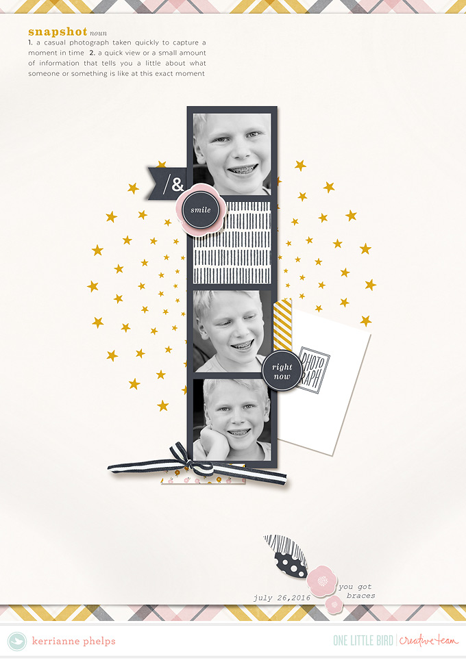 Braces-copy