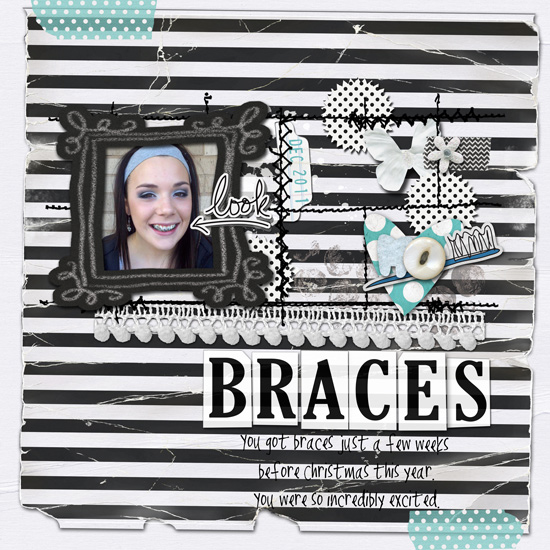 Braces