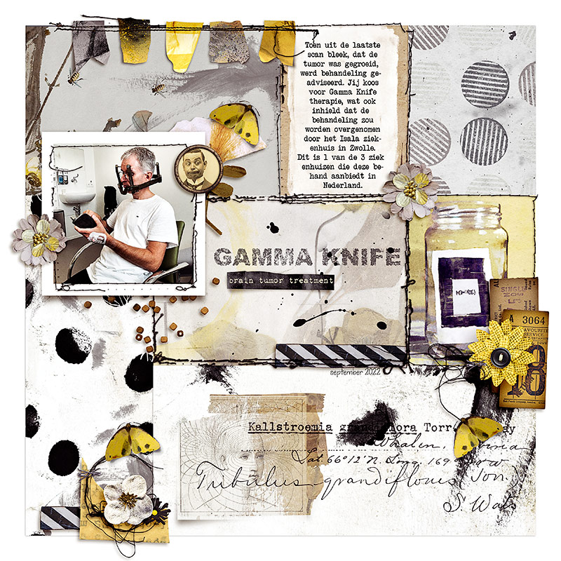 Gamma Knife