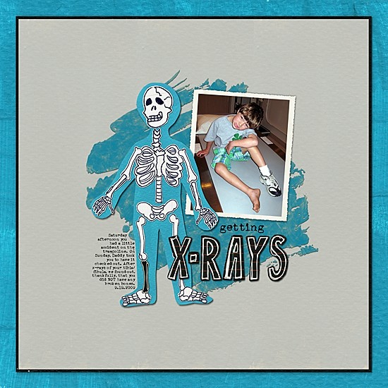 getting x-rays