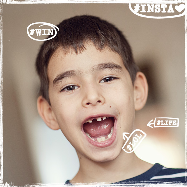 Lost tooth :)