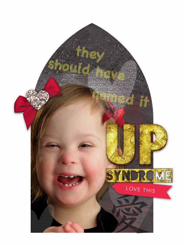 MOC 30 - Up Syndrome