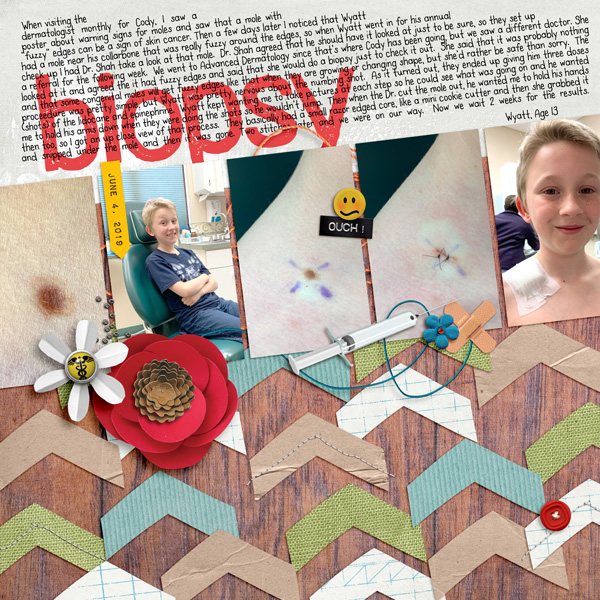 Mole Removal and Biopsy
