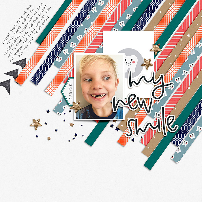 my new smile