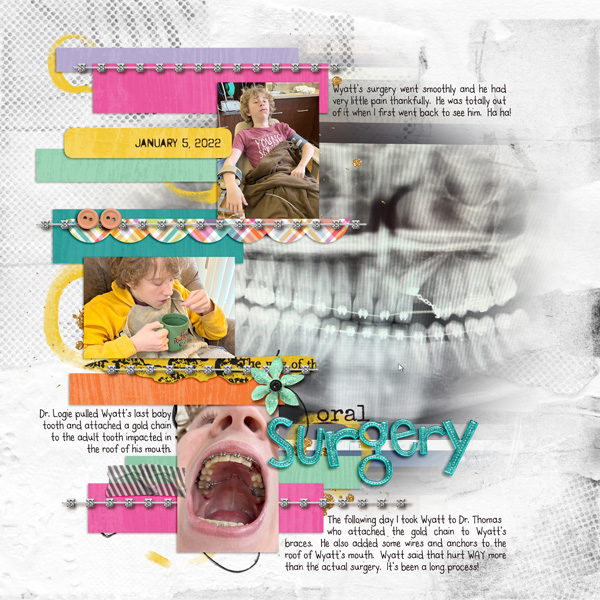 Oral Surgery