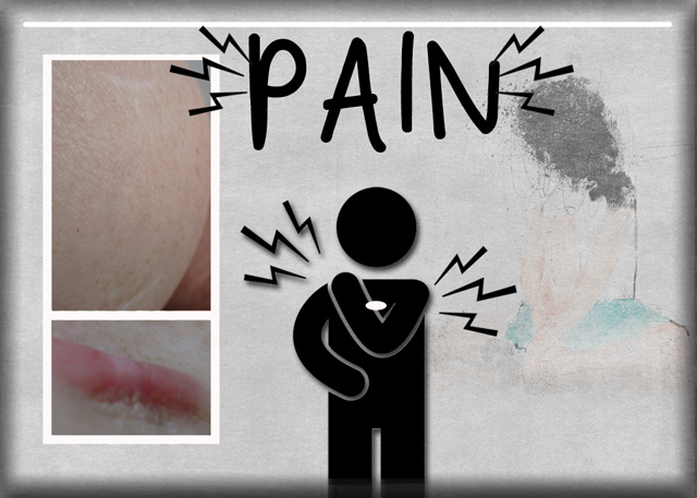 PAIN